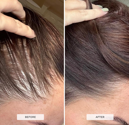 Hair Growth Biotin Gummies